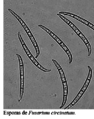 Esporas de Fusarium circinatum.png