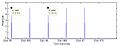Staccato aerophagia waveform.JPG