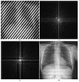 Use of Fourier transformation chest radiography.jpg