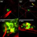 File:A-Novel-Technique-for-the-In-Vivo-Imaging-of-Autoimmune-Diabetes-Development-in-the-Pancreas-by-Two-pone.0015732.s002.ogv