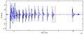 Knocking aerophagia waveform.JPG