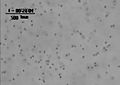 File:A-Novel-Chemotaxis-Assay-in-3-D-Collagen-Gels-by-Time-Lapse-Microscopy-pone.0052251.s001.ogv