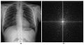 Chest radiograph 2D Fourier Spectrum.jpg