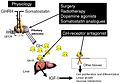 Acromegaly treatment diagram.JPEG