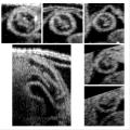 File:Biomechanics-of-the-Chick-Embryonic-Heart-Outflow-Tract-at-HH18-Using-4D-Optical-Coherence-pone.0040869.s004.ogv