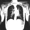 File:Time-Efficient-3D-Radial-UTE-Sampling-with-Fully-Automatic-Delay-Compensation-on-a-Clinical-3T-MR-pone.0150371.s001.ogv