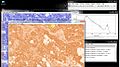 File:IHC-Profiler-An-Open-Source-Plugin-for-the-Quantitative-Evaluation-and-Automated-Scoring-of-pone.0096801.s004.ogv