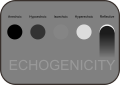 Ultrasound lesions echogenicity.svg