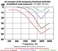 Temporary threshold shift (hearing loss) after noise exposure.jpg