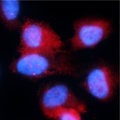 FISH imaging of myc RNA in RPE.pdf